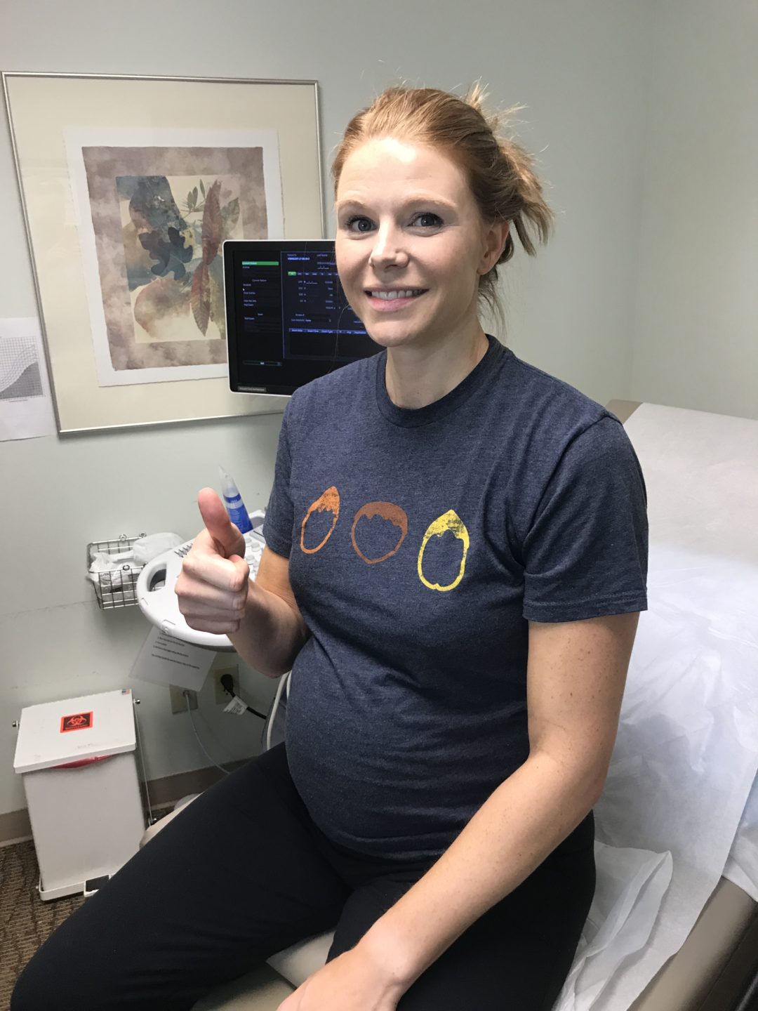 A Gentle C Section For A Breech Delivery Aria Noreen s Birth Story